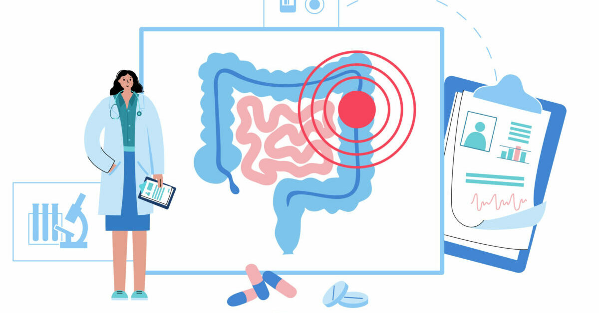 Mars Bleu : ensemble, sensibilisons au cancer colorectal !