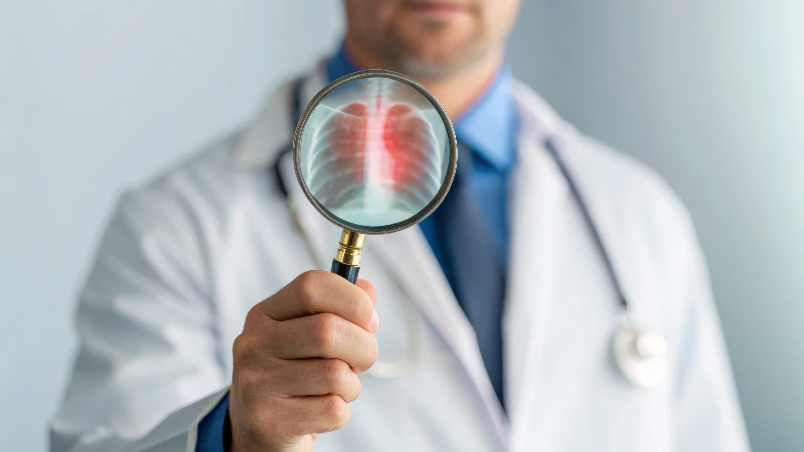 1er août : Journée mondiale contre le cancer du poumon !